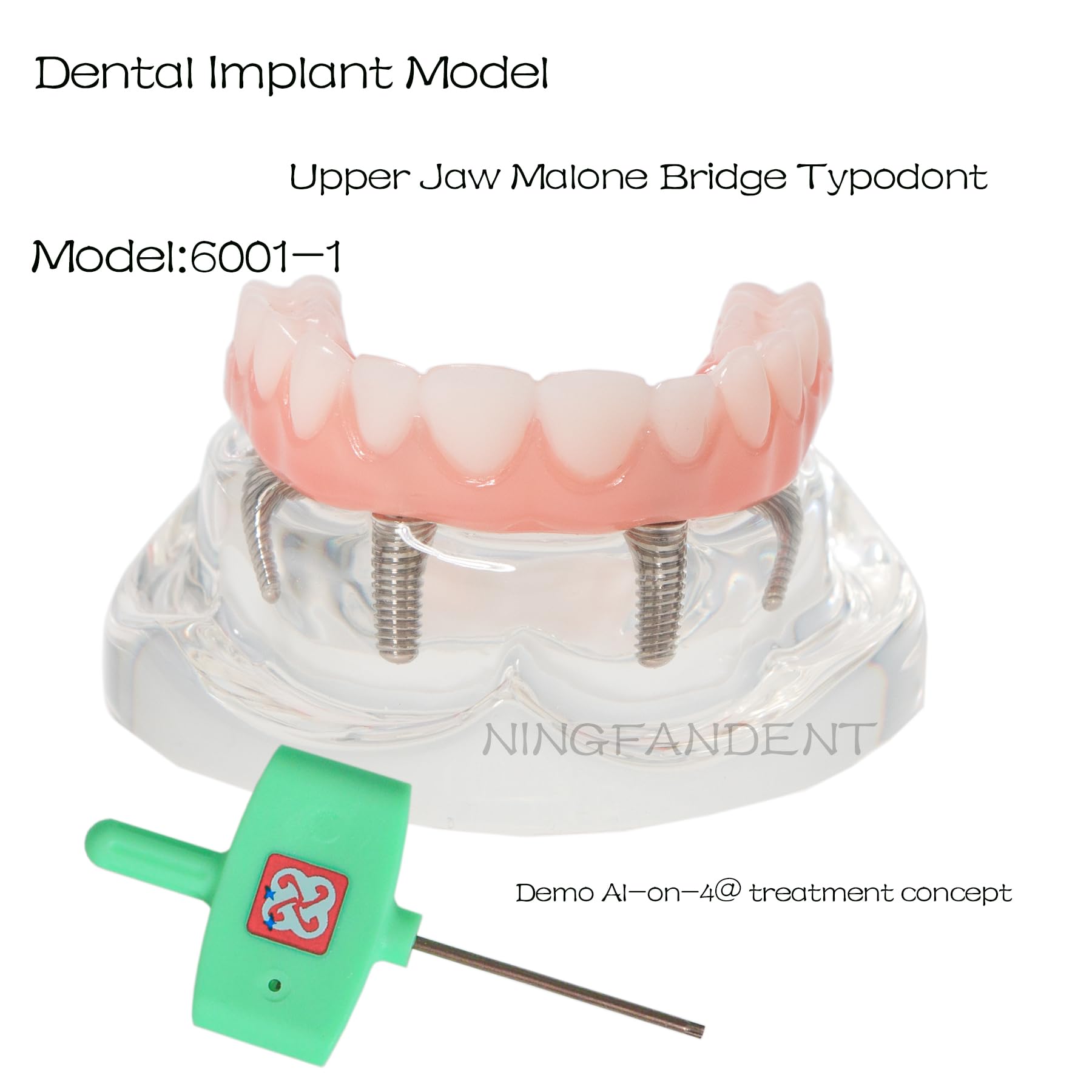 Dental Typodont Implant Restoration Modle All On 4 Overdenture Model Upper Mandible Type Demo Practice Teeth Model with 4 Implants Nails M6001-1