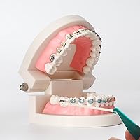 Vista 6 de Paquete de 20 bandas elásticas dentales para aparatos ortopédicos, multicolor, herramienta de banda de goma, desechables de plástico para ortodoncia