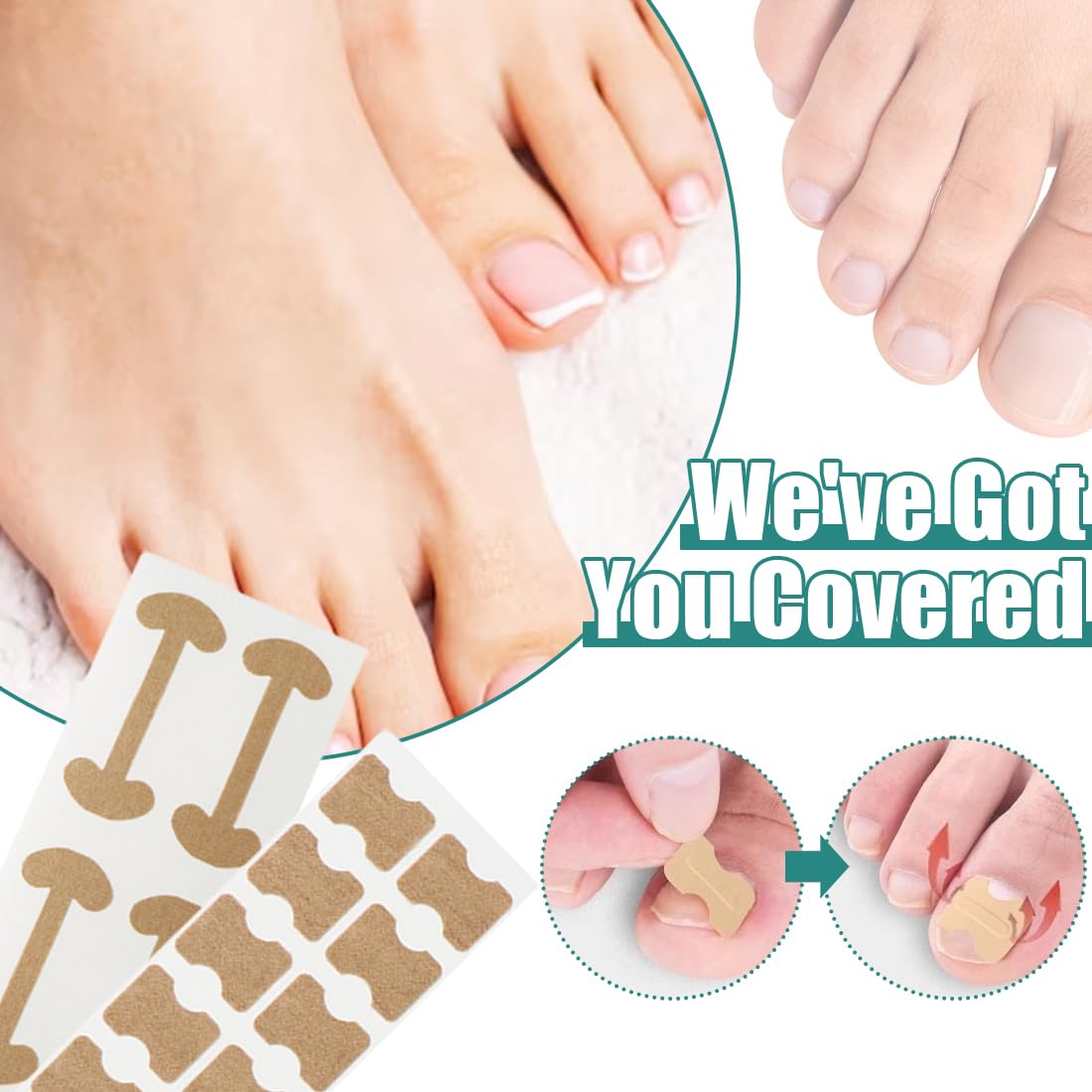 YAYNO Set Correttore per Unghie Incarnite con Cerotti per Unghie Traspirante Strumenti per Pedicure Adesivi Correttori dell'Unghia del Pied Correzione Dell'Unghia Del Piede Incarnite Strumenti