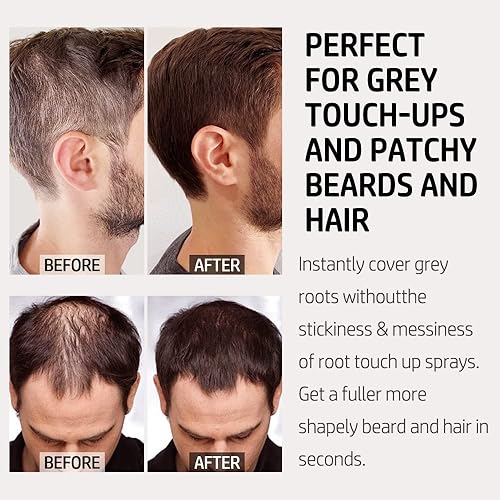 Miniatura 3 de Youngfocus Cubierta de la raíz del cabello