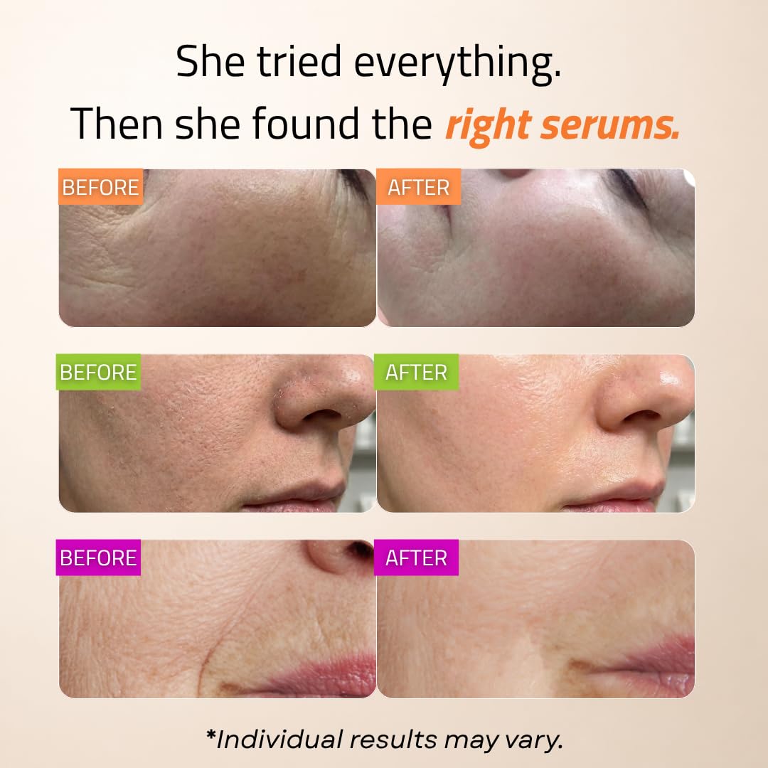 Oferta wprowadzająca – serum z retinolem do twarzy – serum do twarzy z witaminą C z kwasem hialuronowym do twarzy, serum przeciwstarzeniowe z retinolem, serum z witaminą C do twarzy, świecące serum do