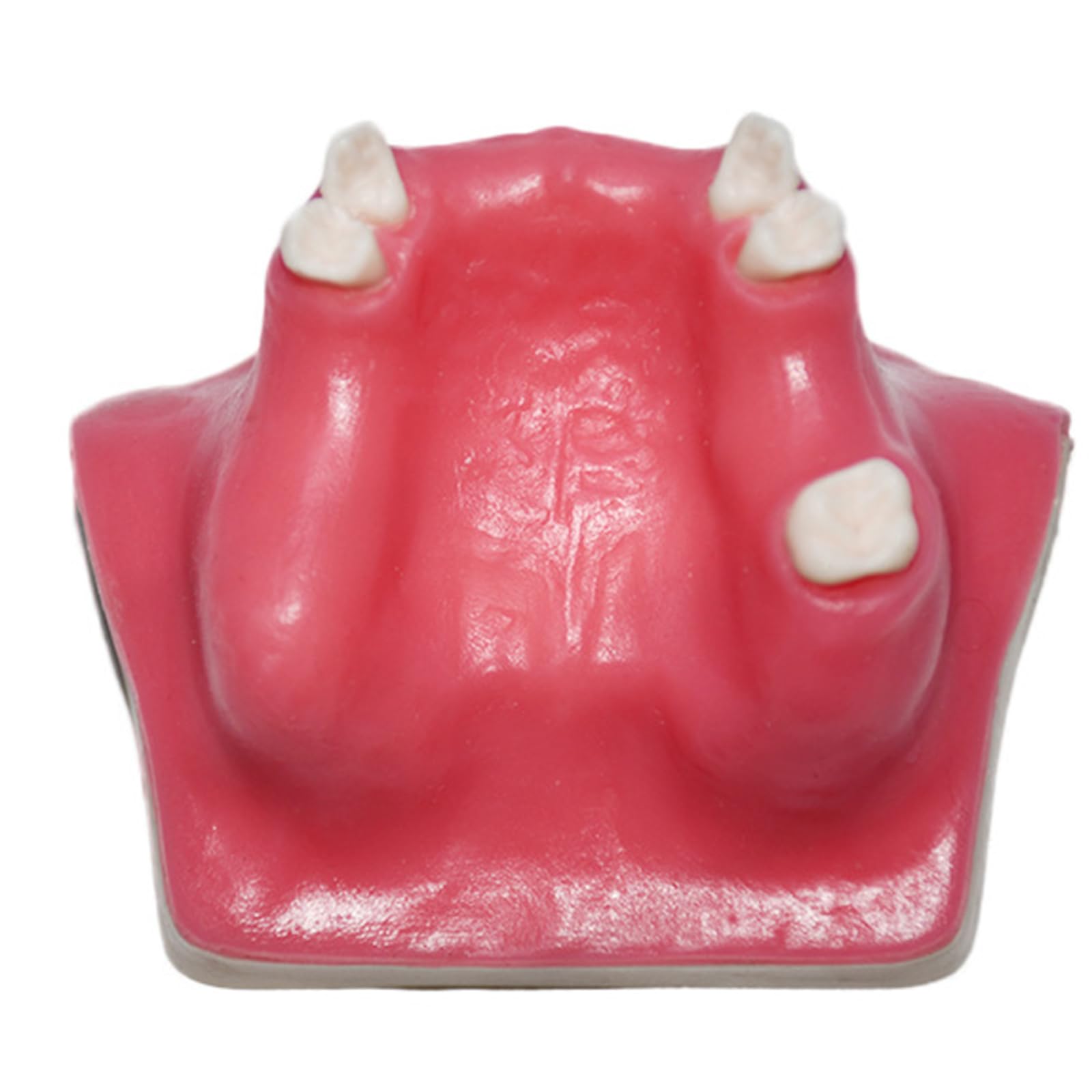 Modello di impianto Dentale - Modello di impianto mandibolare Medico e odontoiatrico - per Studio didattico Displaymedical Model，A9 8cm
