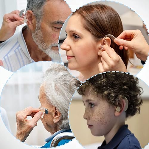 Miniatura 5 de Filtro protector de cera para audífonos compatible con Phonak Unitron Resound, herramienta de limpieza de oídos, diámetro: 0.079 in, 8 unidades