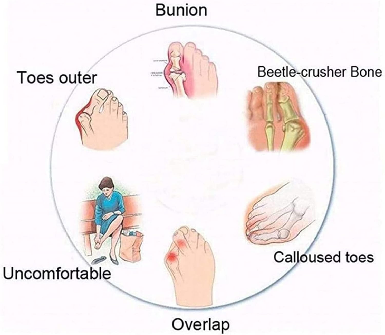 Sandalia De Hombre Big Toe Hallux Valgus, Férulas De Juanete Planas, Chanclas Correctoras De Pie, Cómodas, para Corrector De Dedos, Brown, 6.5 UK