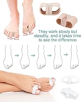 Vista 5 de BLATOWN 4 separadores de dedos correctores de juanetes para mujeres y hombres, espaciadores de gel para dedos grandes con 2 bucles para pies