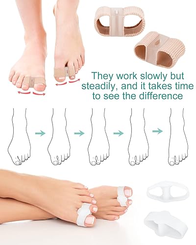 Miniatura 5 de BLATOWN 4 separadores de dedos correctores de juanetes para mujeres y hombres, espaciadores de gel para dedos grandes con 2 bucles para pies,