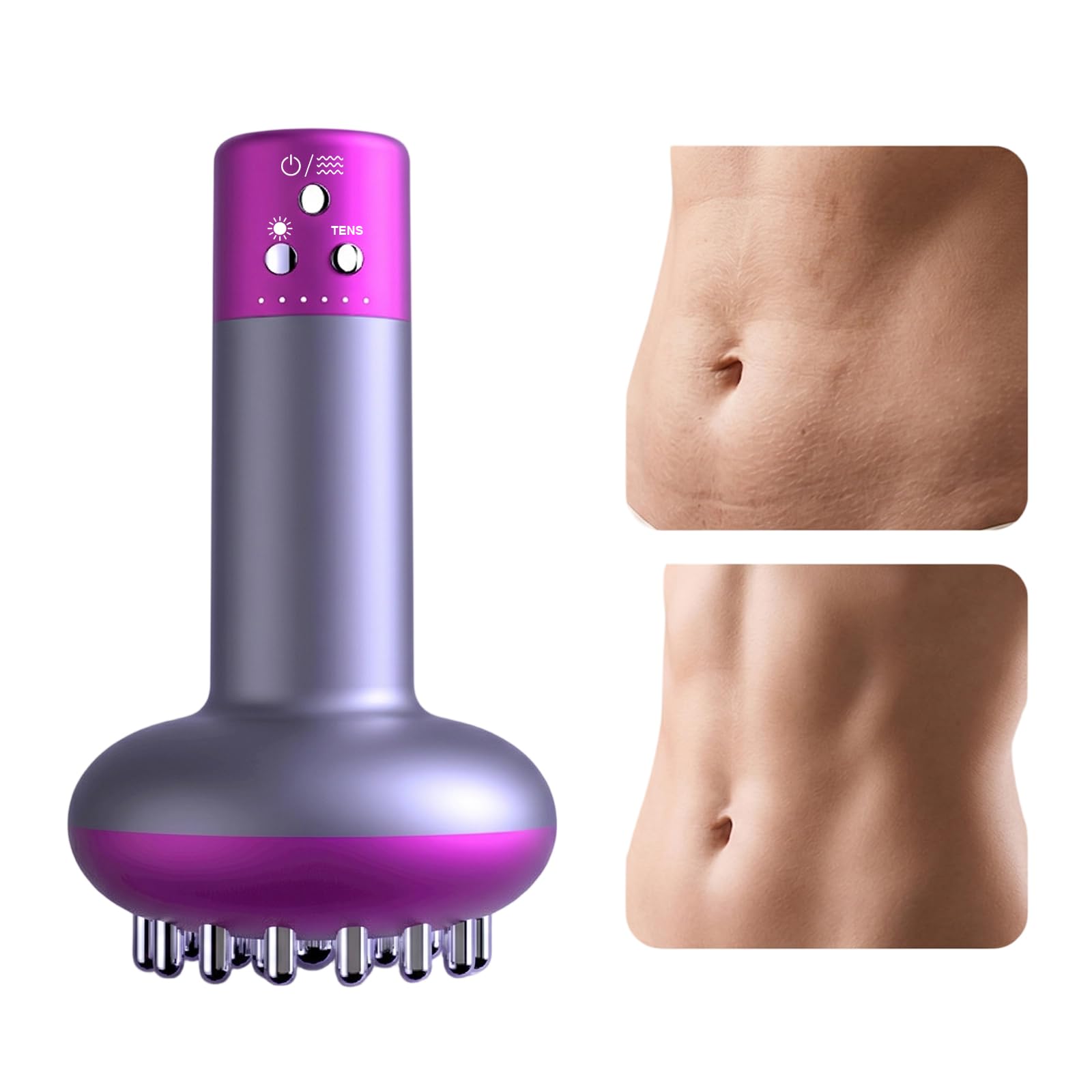Massaggiatore Anticellulite & Drenaggio Linfatico, con Calore, Luce Rossa, Vibrazione e Microcorrente, 6 Modi per Gambe, Braccia e Addome