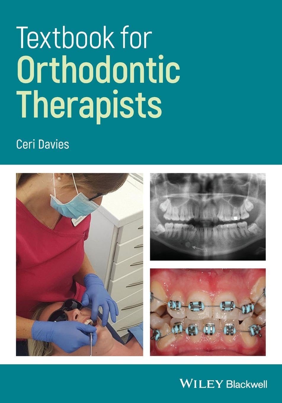 Textbook for Orthodontic Therapists Davies Paperback Wiley–Blackwell