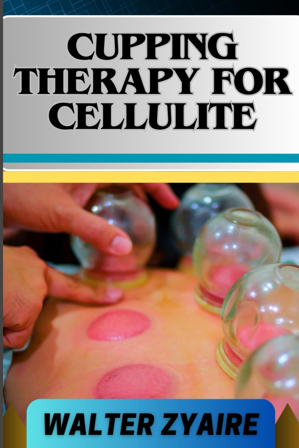 CUPPING THERAPY FOR CELLULITE: A Complete Guide On Unveiling The Art To Smooth Skin And Cupping Odyssey To Wellness