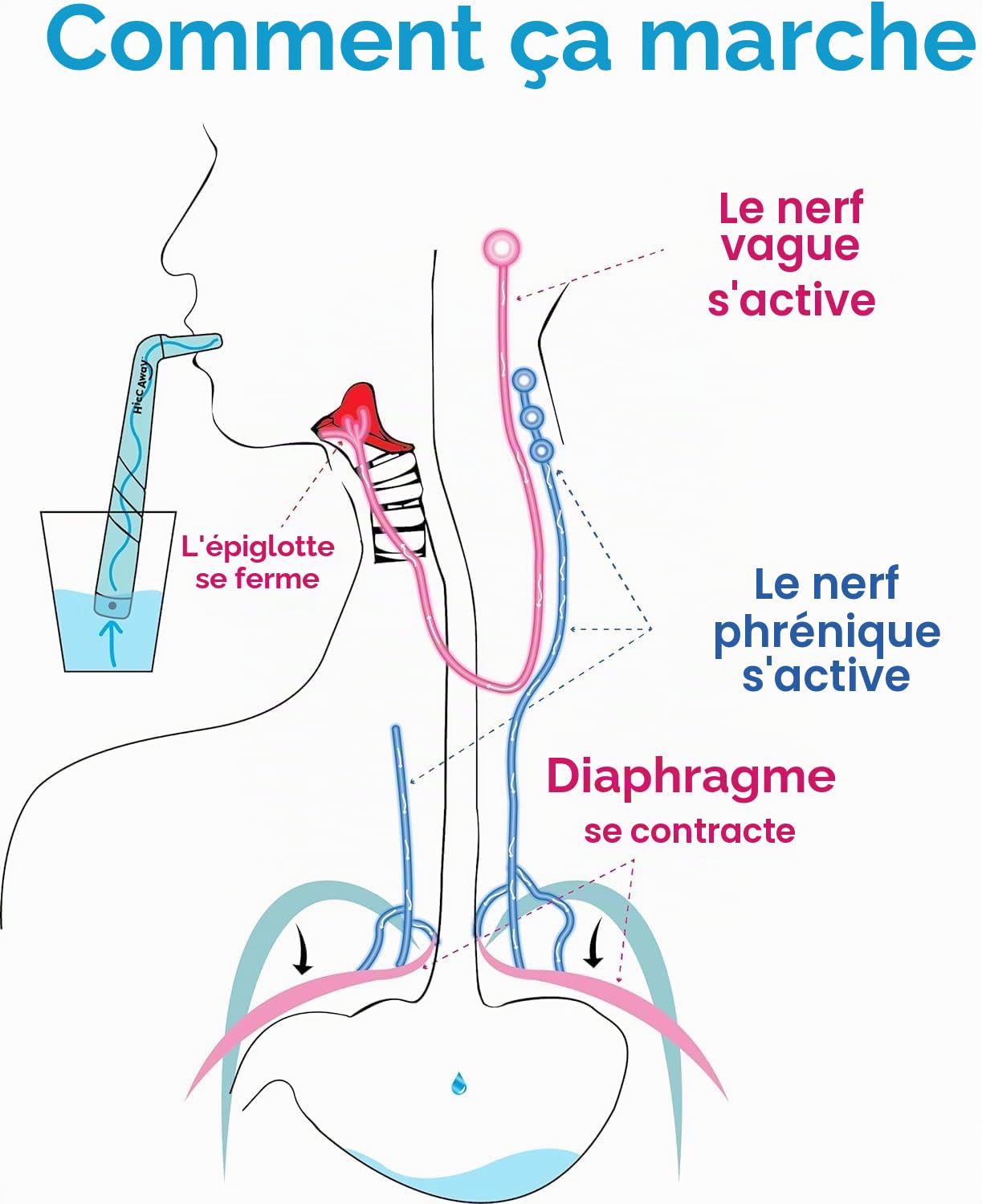HiccAway Paille à hoquet – Arrête le hoquet naturellement et rapidement – ​​Soulagement cliniquement prouvé pour tous les âges, enfants et adultes – Sûr, léger et réutilisable (Malibu Bleu) 1 paquet
