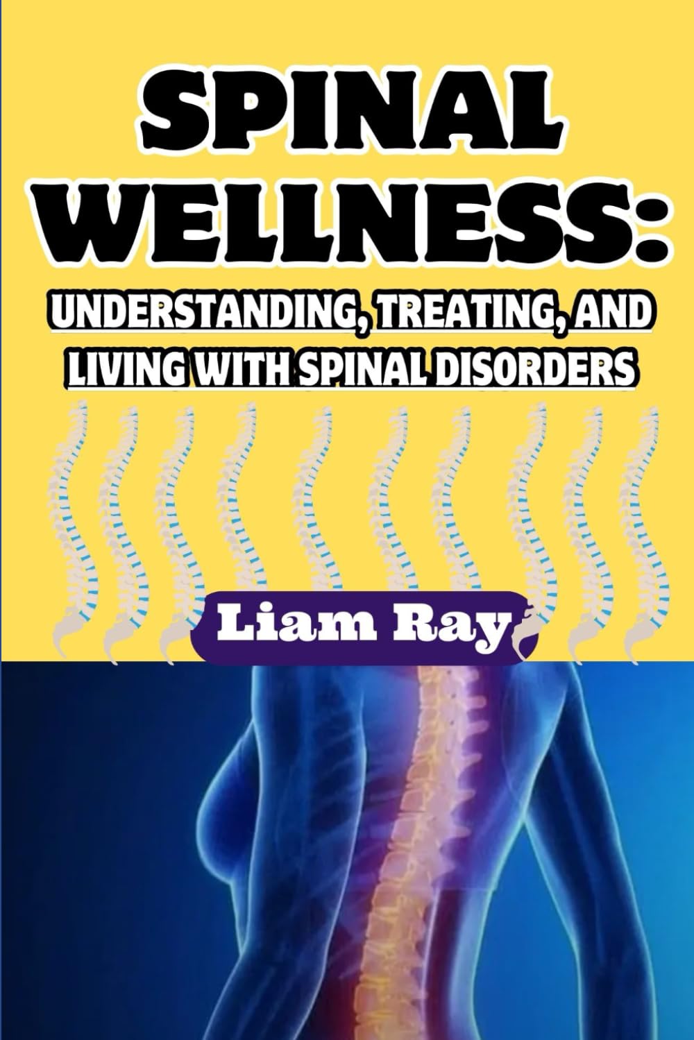 SPINAL WELLNESS:: UNDERSTANDING, TREATING, AND LIVING WITH SPINAL DISORDERS
