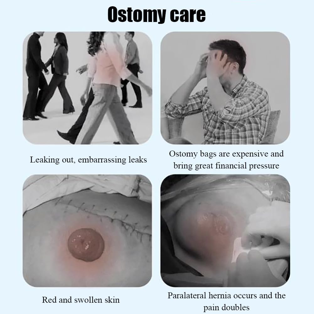 Cinturón de Soporte para ostomía, para Bolsa de ostomía Fija Previene la Hernia paraestomal Cinturón de Soporte para Hernia Unisex Cinturón para Hernia,4.5cm