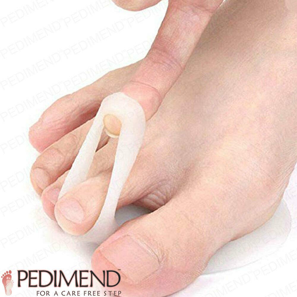 Pedimend Mortons Neuroma Laufunterstützung – 4 Stück | druckentlastende Einlagen | Metatarsalgie Einlegesohlen | schnelle Schmerzlinderung schmerzende Füße | Ballenfußpolster
