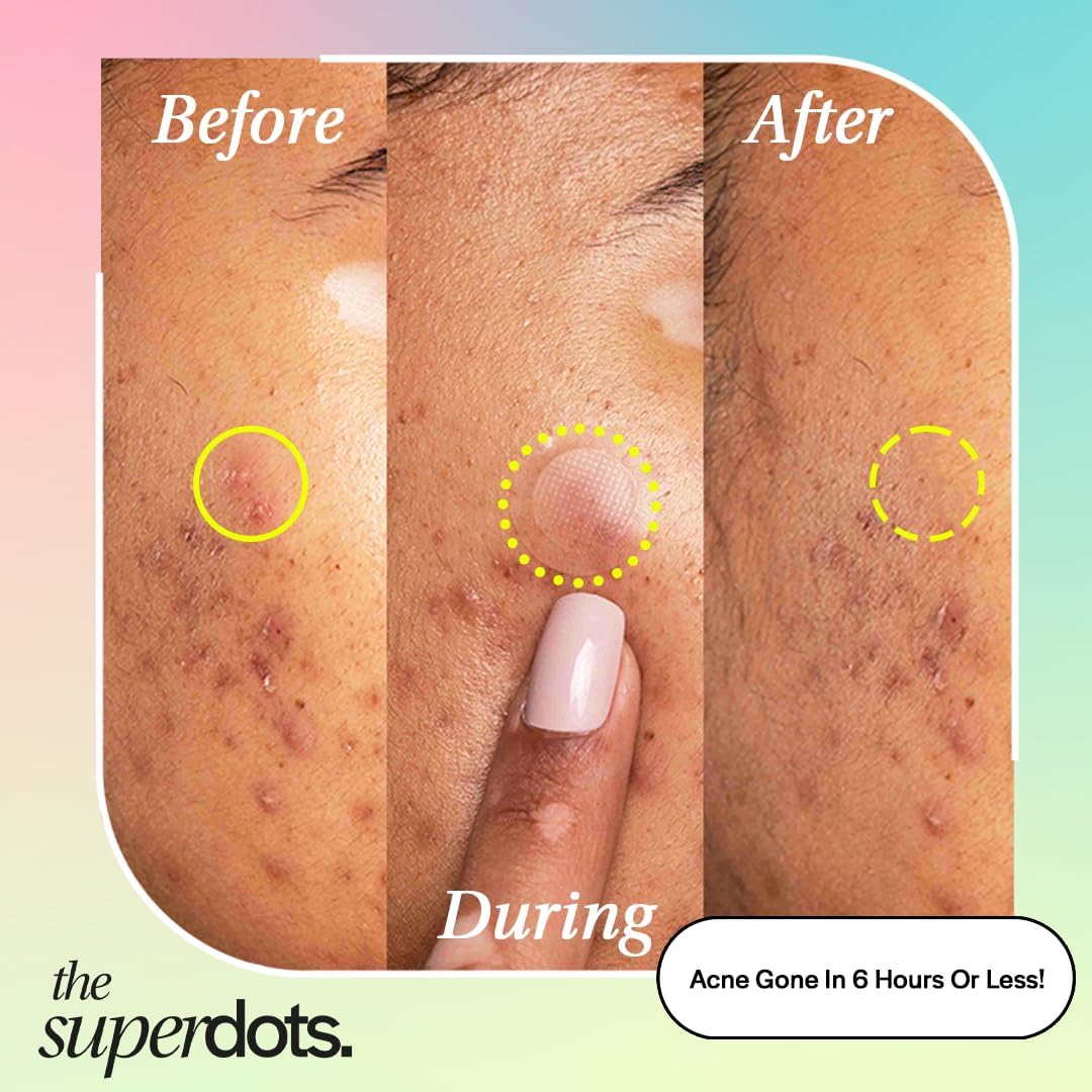 The Superdots, Translucent, 1 count (Pack of 6) - Image 2