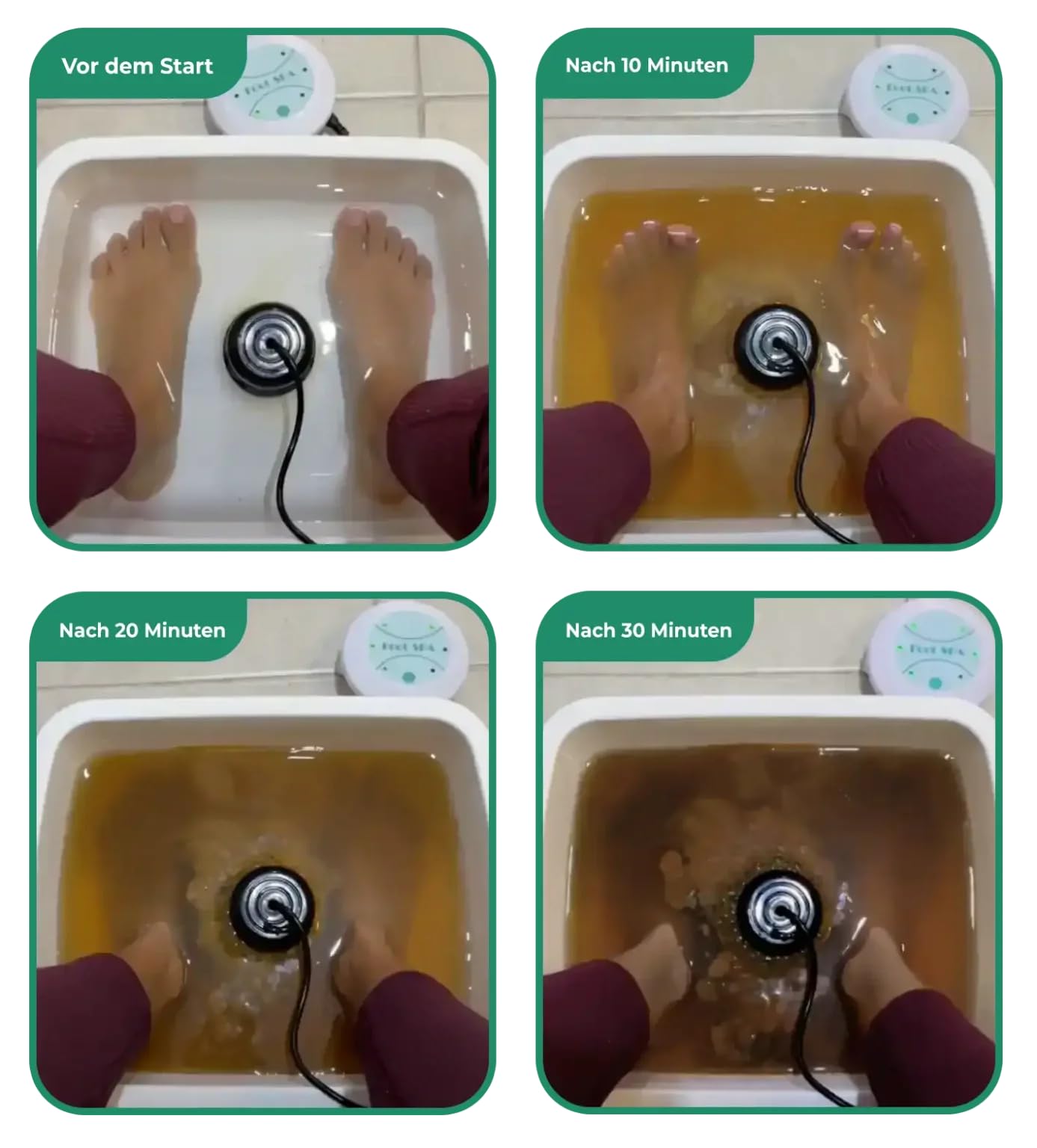 nooroa Dr Detox Ionische Detox-Fußbadmaschine – Tragbares Fußpflege-Set mit Elektrolyse, inklusive Fuß-Spa und Reinigungszubehör
