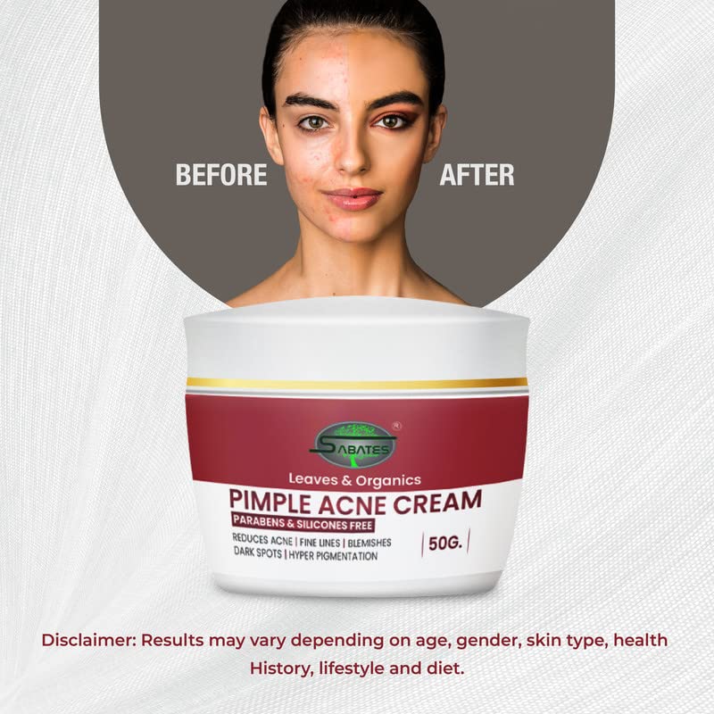 SABATES Pimple Acne Cream Anti-Acne Oil-Free Gel For Active Acne, Oil Balancing, Pore Tightening, Reduce Size Of Pimple & Redness For Men & Women (Zero Side-Effect) 1
