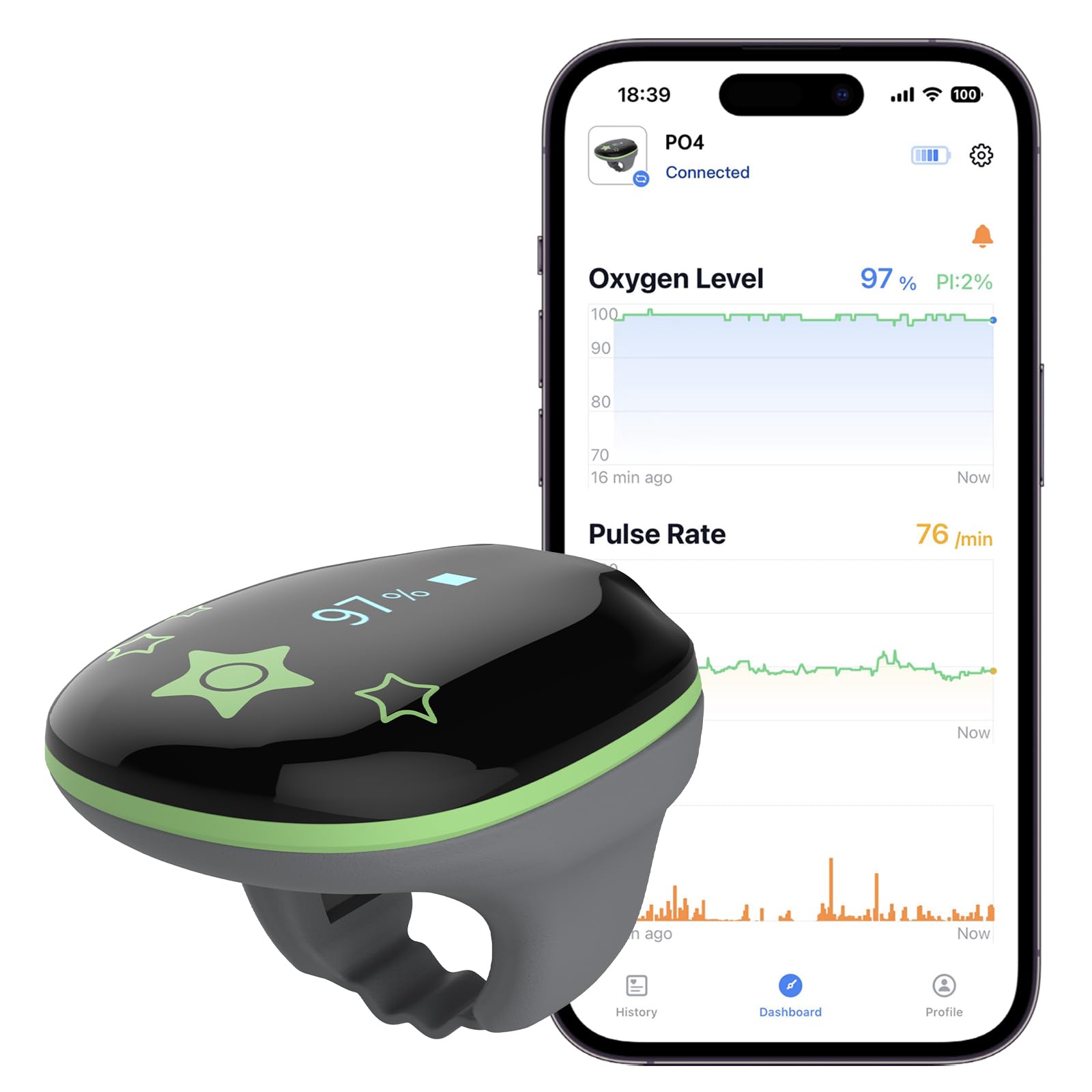 Photo 1 of Pulse Oximeter Ring for Very Small Finger, Continuous O2 Sat Monitor Finger for Oxygen with Audible Beep, Rechargeable Pulse Ox Tracking Blood Oxygen Saturation & Pulse Rate, with App & PC Chart Report