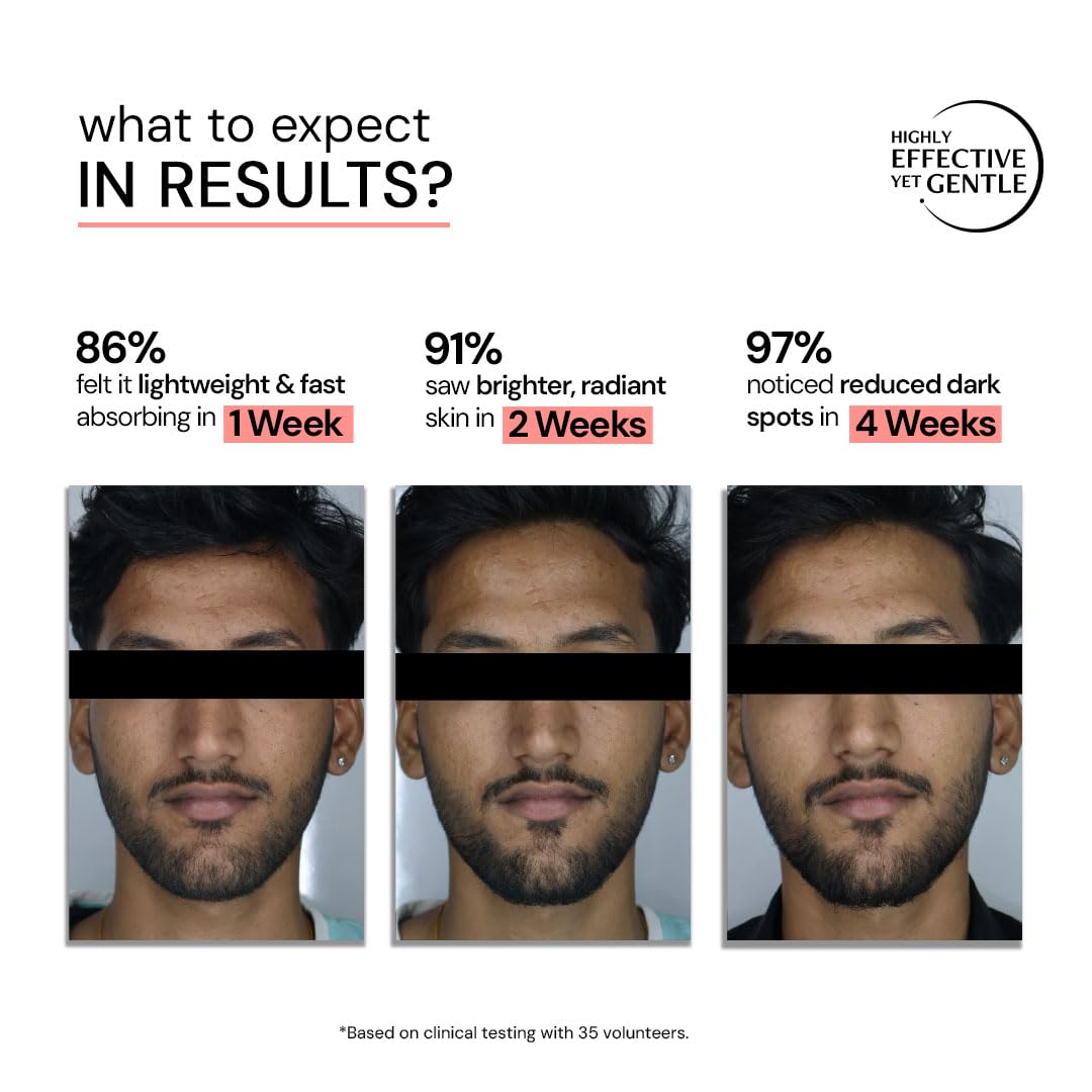 Deconstruct 5% Niacinamide Serum for Oily Skin + 2% Alpha Arbutin|Powered by Liposomal Technology |Fades Pigmentation & Acne Marks|4-in-1 Multi-Benefit| Co-created with Dermatologists| Non-Irritating | 10ML 4