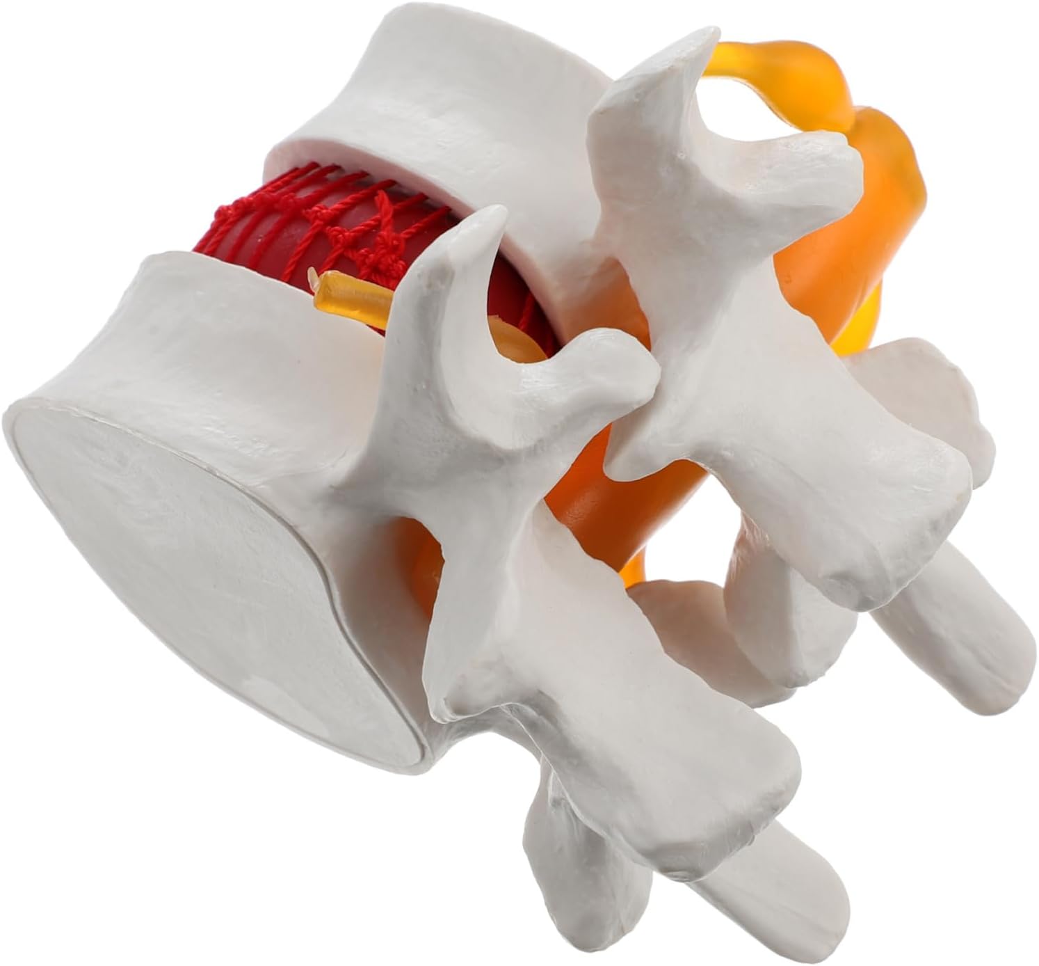 1Pc Human Spine Model Lumbar Disc Herniation Anatomy Presentation for Teaching Medical Use Portable Design Smooth Surface for Easy Cleaning for Students Professionals