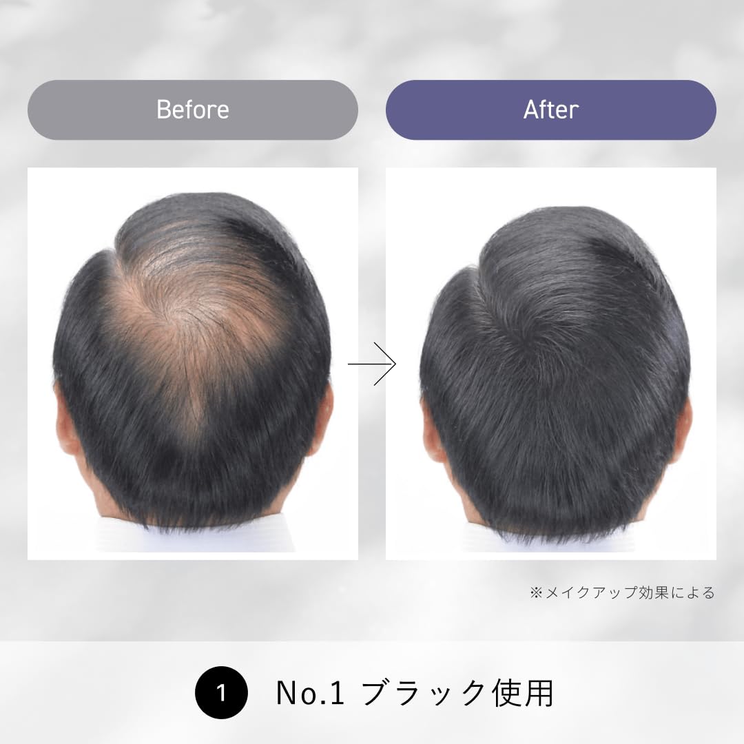 Amazon | スーパーミリオンヘアー コンパクトセット No.1ブラック