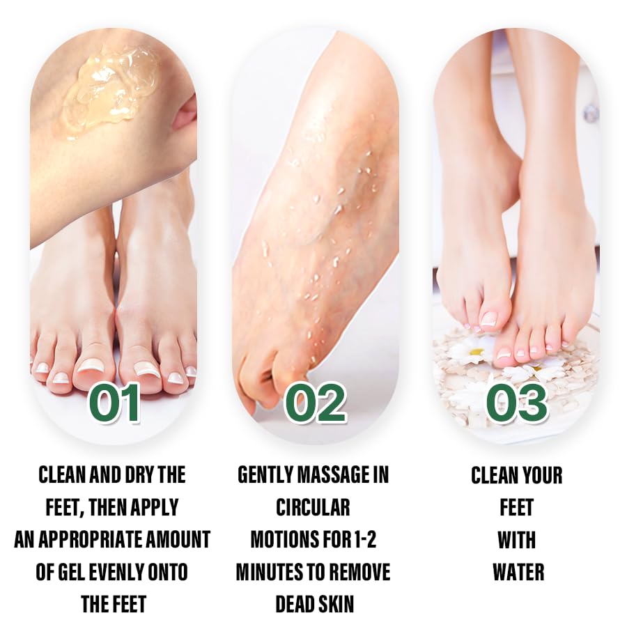 Glycolic Acid Foot Exfoliating Gel 10.15 fl oz Foot Peeling Gel Callus Remover Dead Skin Remover for Feet with Fruit Acids Lemon Lime Bilberry Hydrating Foot Peel for Smooth Soft Feet