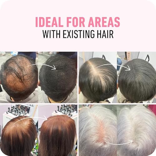 Boldify BLD0112LB Hair Fibers (12G) Fill In Fine And Thinning Hair thumb #3