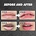 Lip Lightening Lip Balm for Dark Lips – Lip Softening & Hydration,Help Fade Dark Lip Discoloration, Moisturizing Lip Balm for Smokers,Reduces Discoloration & Fine Lines,for Men And Women