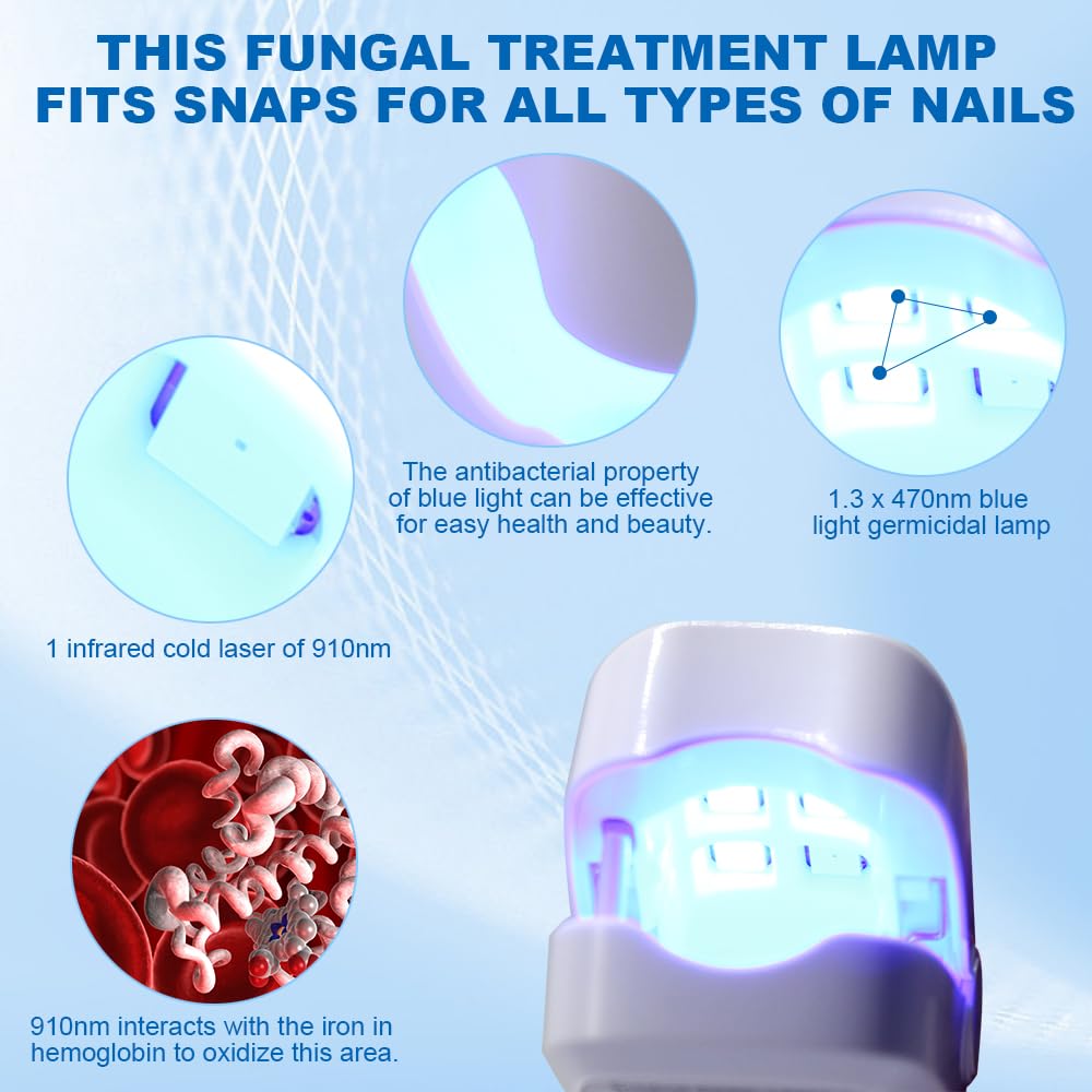Dispositivo per Terapia con Luce per Funghi Delle Unghie, Fungo Delle Unghie, Fototerapia Fungo, per Terapia Laser a Freddo Portatile, per la Pulizia e la Cura Delle Unghie