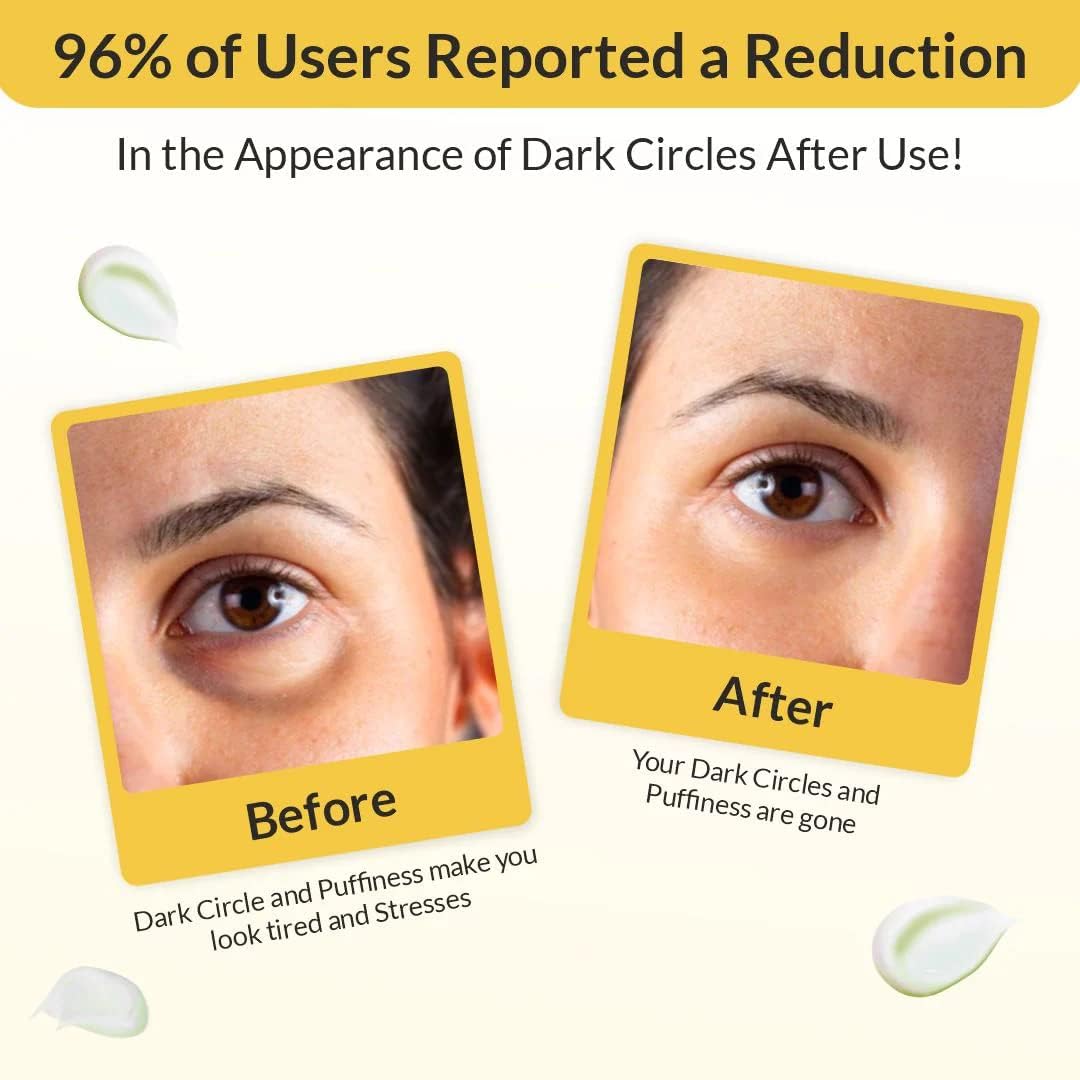 Eyecirque Under Eye Gel with Retinol, Niacinamide, Glutathione & Ginseng extract | Under Eye Serum to Reduce Dark Circles, Puffiness & Fine Lines | Hydrating Eye Gel for Men & Women 30 g — Amazon image 3