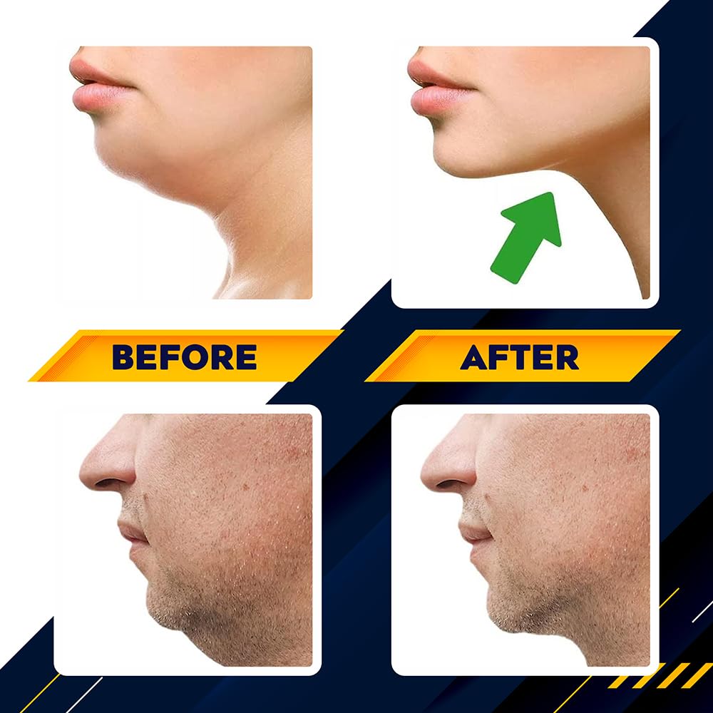 Jawline Trainer & Mascella – Rimozione mento doppio & Jawline Exerciser per un efficace allenamento della mascella e costruzione muscolare, per fitness e sport per uomini e donne
