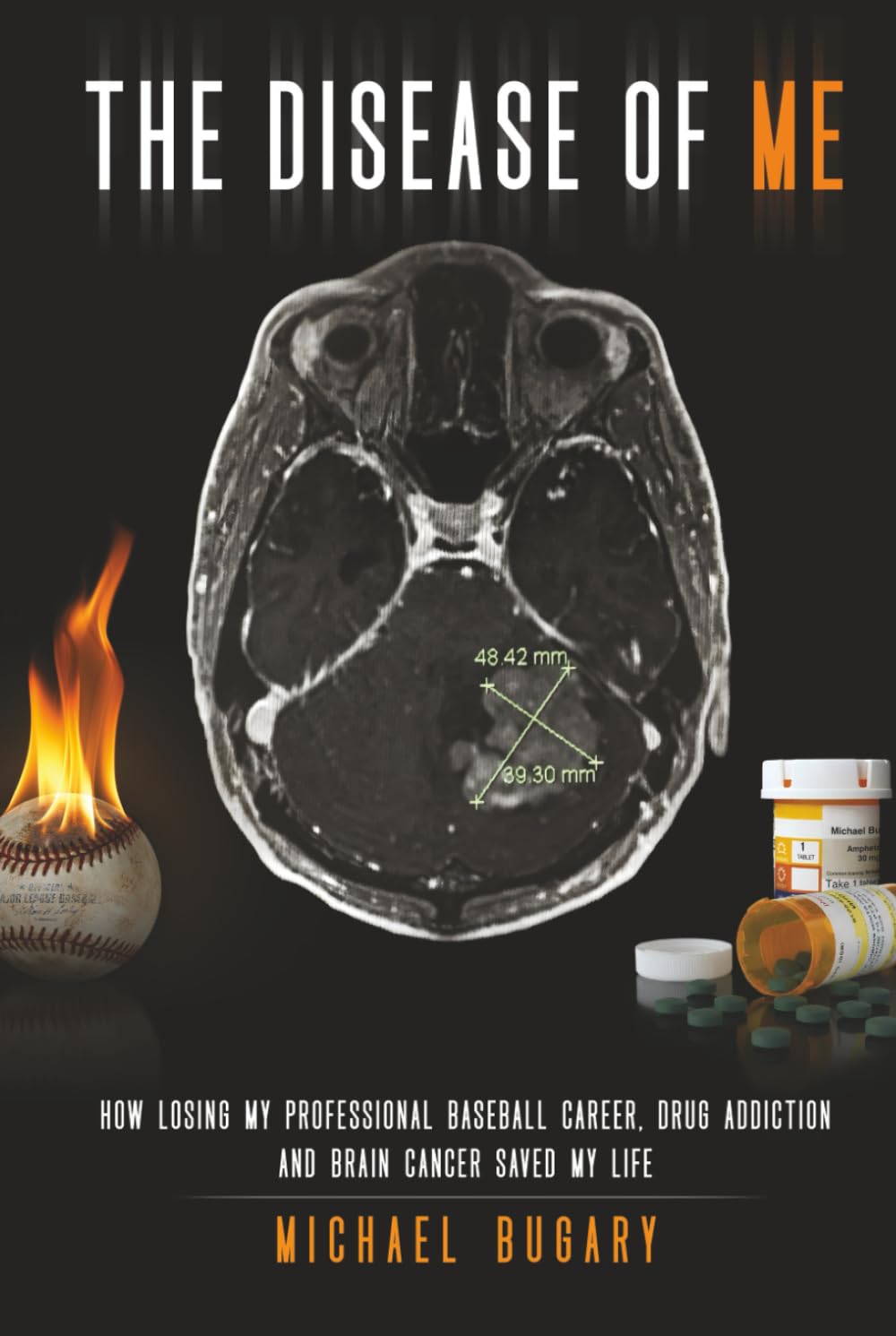 The Disease of Me: How Losing My Professional Baseball Career, Drug Addiction, and Brain Cancer Saved My Life