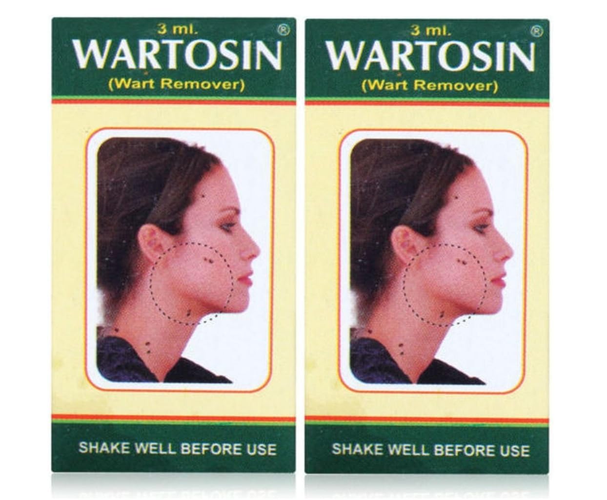 Wartosin Wart Remover | Massa Remover Herbal and Ayurvedic Solution 3ml (Pack of 2)