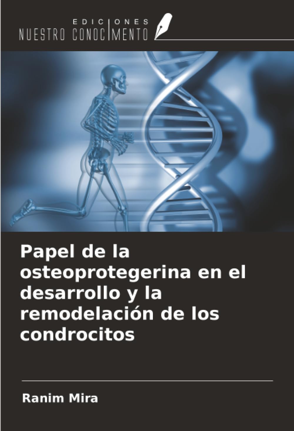 Papel de la osteoprotegerina en el desarrollo y la remodelación de los condrocitos
