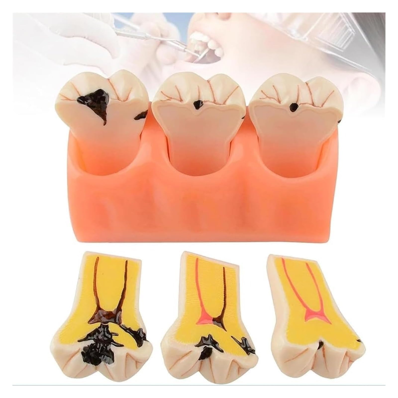 Standardowy model zębów dla dorosłych dentystów, realistyczny projekt symulacji i doskonałe wykonanie do nauczania, akcesoria do próchnicy zębów dla dentystów, nauczycieli uczniów nauczania anatomii