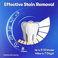 Vista 3 de Tiras blanqueadoras dentales MySmile, Tiras blancas con infusión de hidroxiapatita, Blanqueamiento dental sin sensibilidad con ingredientes