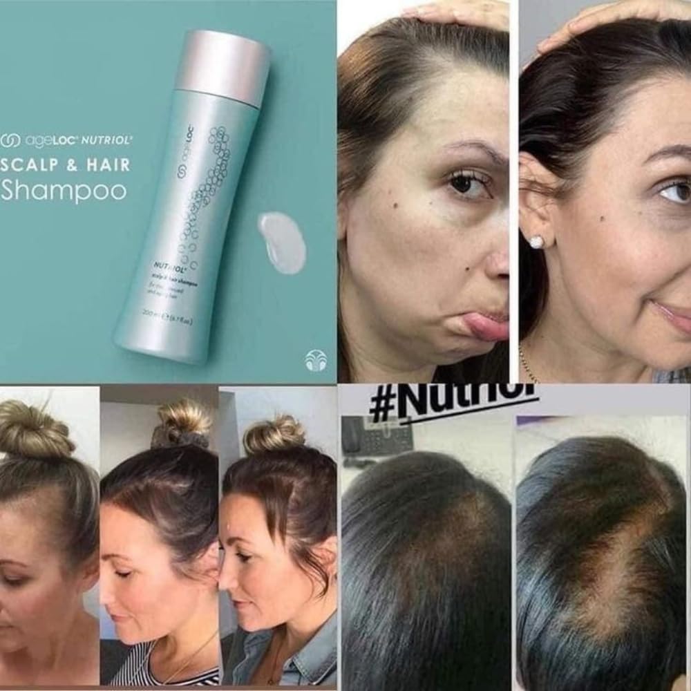 Nu. Skin age. LOC Nutriol Scalp & Hair Shampoo Scalp & Hair Shampoo For Thin Stressed And Ageing Hair, 200 ml (Pack of 1) - Image 2