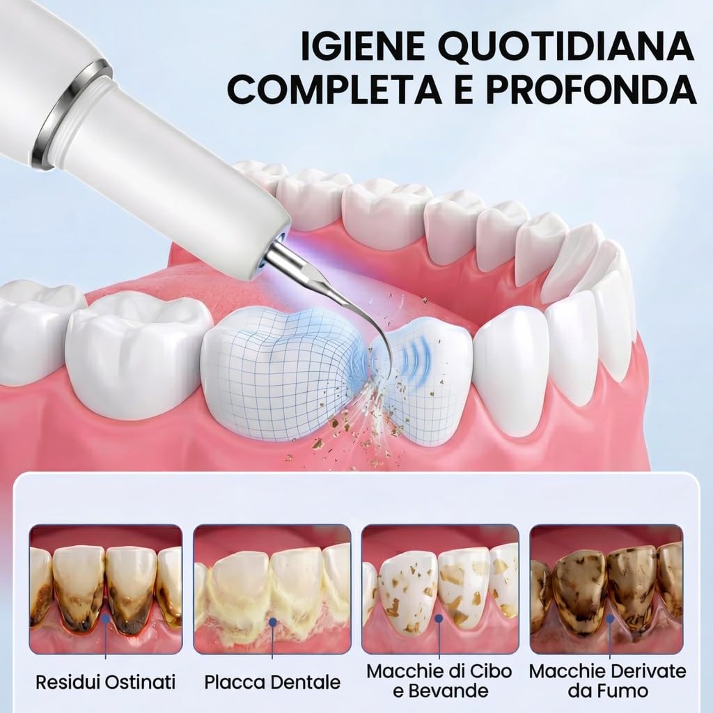 Kit Pulizia Denti Tartaro，Spazzolino Elettrico Ultrasuoni Intelligente con 5 Modalità Per Rimozione Placca e Macchie con 5 testine intercambiabili e Luci LED per Pulizia Tartaro Uso Quotidiano a Casa