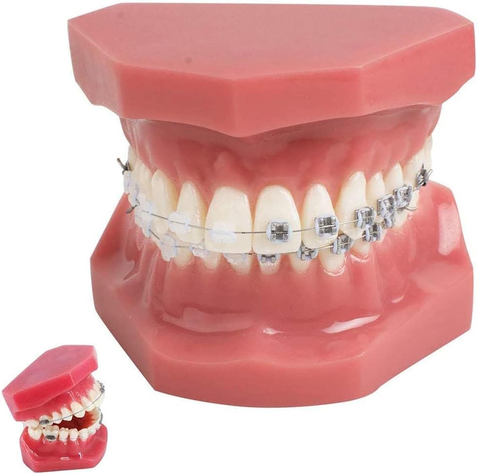Zahnärztliches kieferorthopädisches Modell, Zahnmodell mit Metall- und Keramikklammern, orale Demonstrationsmodelle for den zahnärztlichen Unterricht oder die Kommunikation mit dem Zahnarzt.