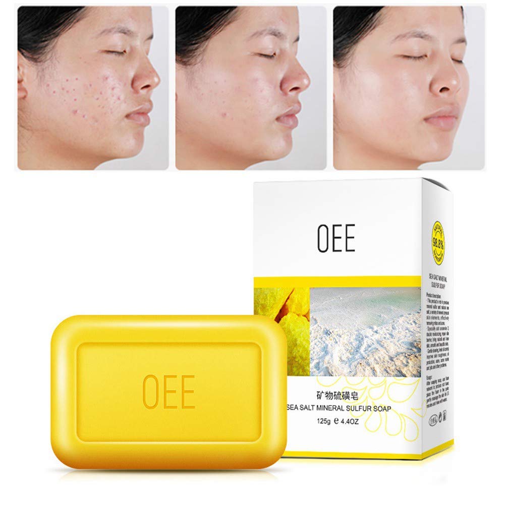 Buy Sea Salt Mineral Sulfur Soap, KISSION 125g Acne Soap from Tinea
