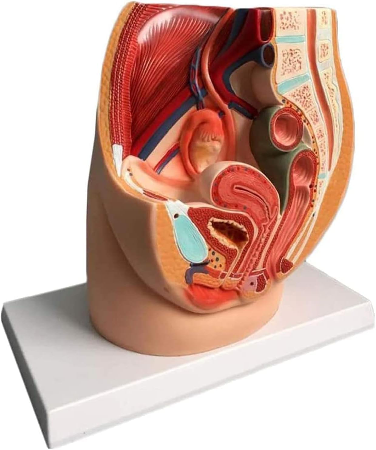 Model Anatomiczny Miednicy żeńskiej, Przekrój Strzałkowy Pośrodkowy, Ginekologiczne Zapalenie Gruczołu Krokowego Z Więzadłami, Naczyniami, Nerwami, Dnem Miednicy I Narządami, Do Szkoleń Med