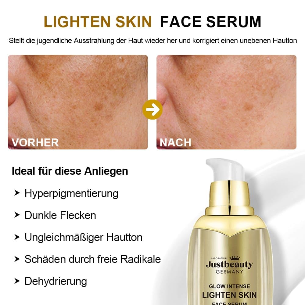 Glow Intense Kollagen-Aufhellungsset - Body Lotion, Gesichtscreme, Serum, Toner, Reinigung - Klärt, Spendet Feuchtigkeit, Hellt auf - Mit Kollagen, Niacinamid, Vitamin C (1, Kilogramm)