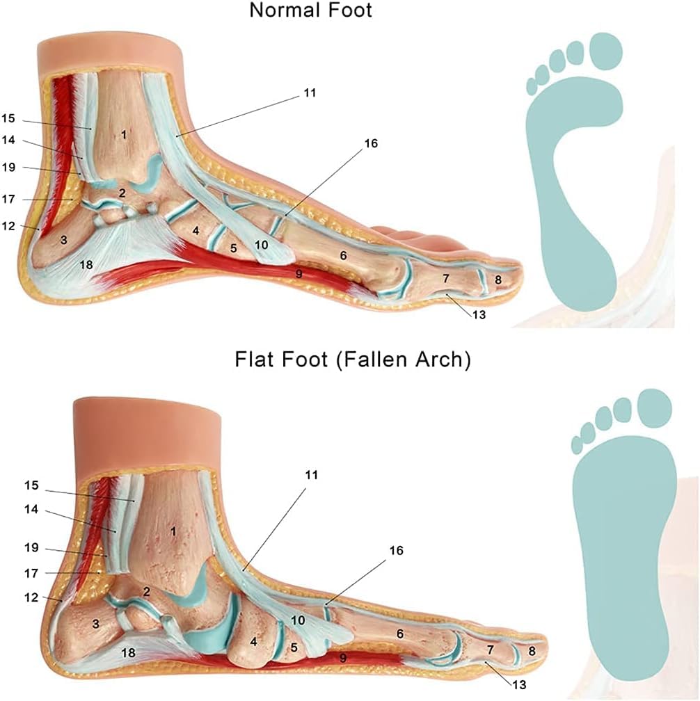 Menschliches Fußmodell, 3-teiliges Fußmuskel-Anatomiemodell, menschliches Fußpodologie-Modell, Normale Fußanatomie, Plattfuß und Fuß mit hoher Einzahlung