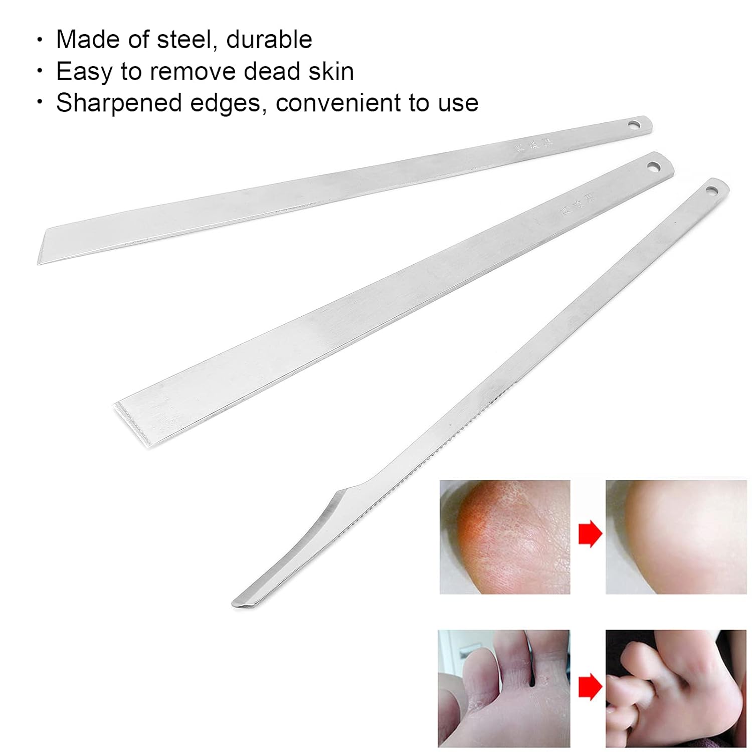 Pedicure Tool Set, 3pcs Pedicure Blade Cuticle Remover Steel Toenail Correction Tools Ingrown Toe Nail Correction Remover Ingrown Toenail Tool Pedicure Remove Tool Pedicure Tool for Ingrown Nails : Beauty & Personal Care