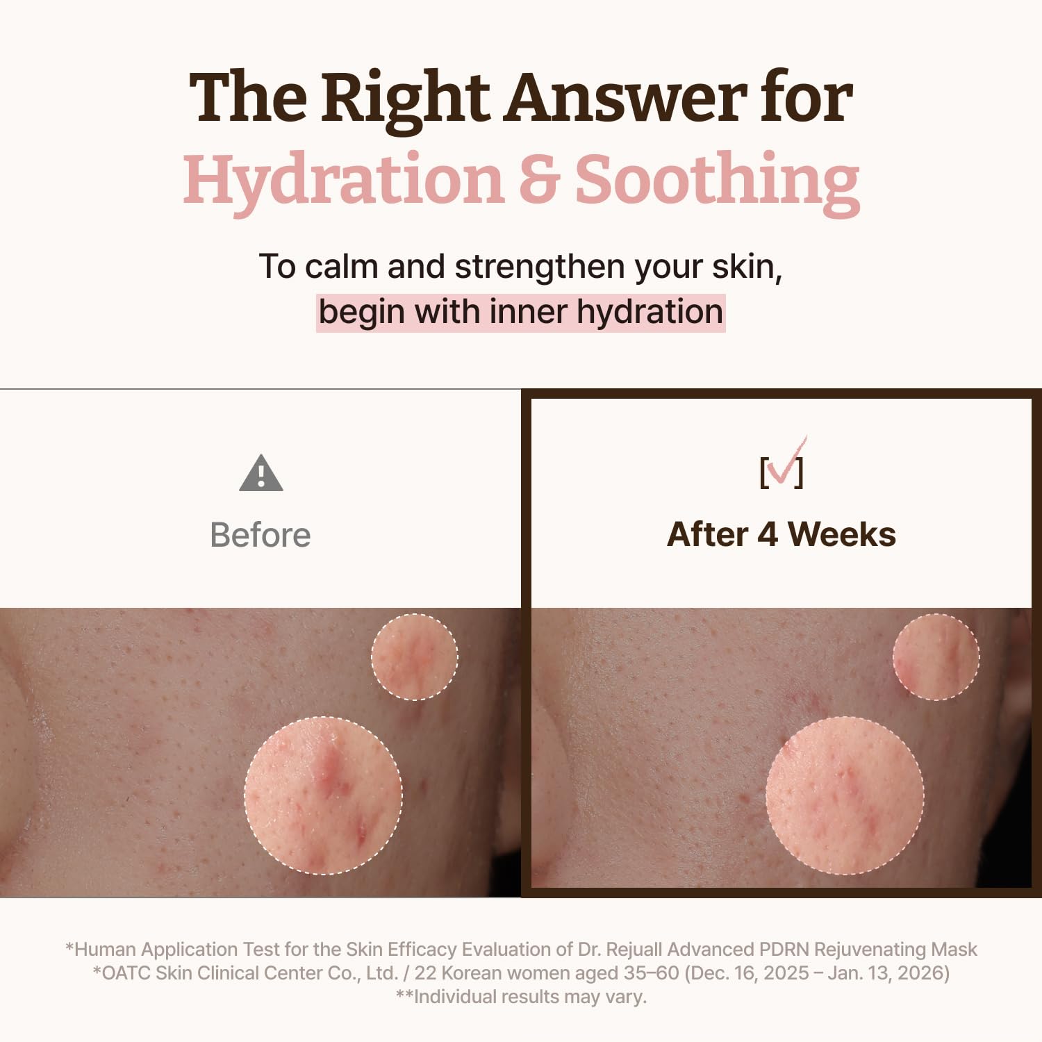 Dr. Reju-All Advanced PDRN Rejuvenating Mask - Face & Neck Korean Sheet Mask with 1,200 ppm PDRN, Collagen & Copper Peptides - Hydrating & Soothing, Skin Repair (36g x 4EA) - 5