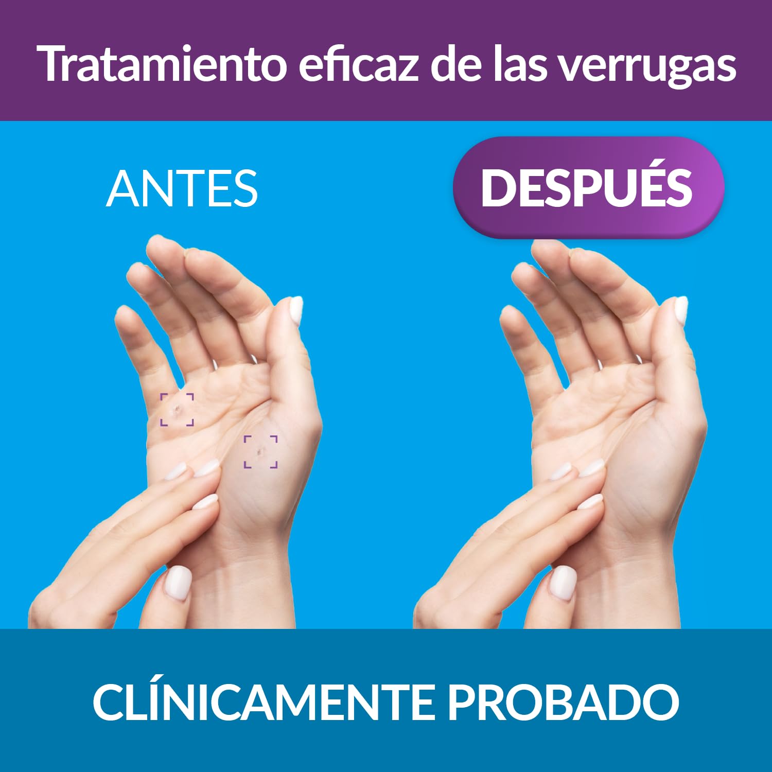 Excilor Gel Antiverrugas 4 Ml