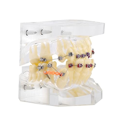 Miniatura 7 de Demostración Ortodoncia Oral Care Kits Modelo Dientes Enseñar Herramientas de Estudio con Soporte de Metal para Enseñar Herramientas de Estudio