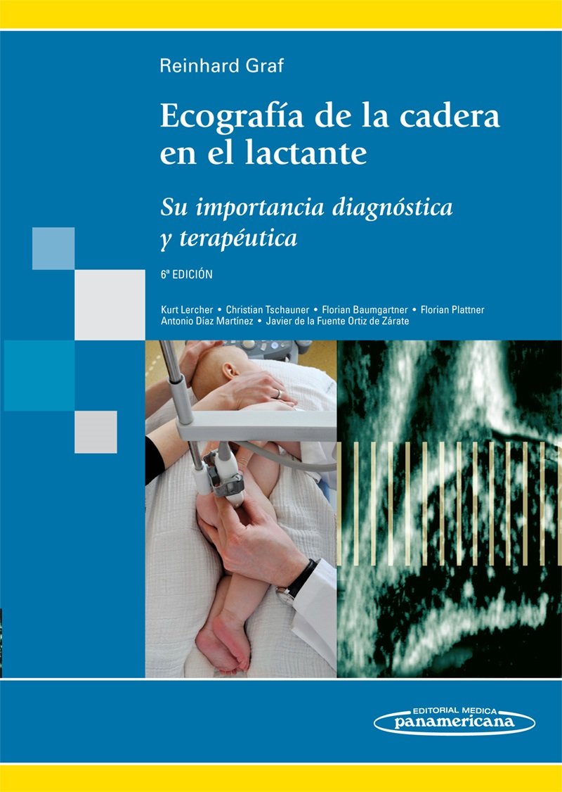 Ecografia de la cadera en el lactante: Su importancia diagnóstica y terapéutica