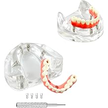 New Dental Implant Model, YOUYA DENTAL All-On-4 Implants Lower Jaw Malone Bridge Teeth Models, Dental Overdenture Teeth Model with Removable Recondition Implants for Education Teaching