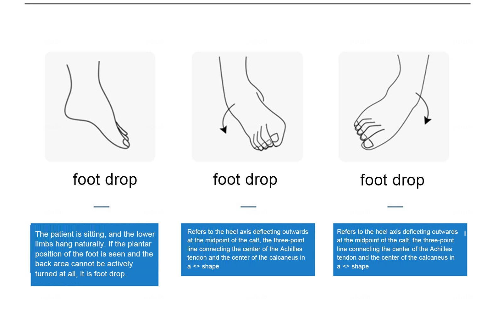 VIDECOR AFO Foot Drop Tutore Medico Foot Up Caviglia Piede Ortesi Supporto per Emiplegia Ictus, Tutore Leggero per Piede Cadente per Camminare Meglio,Left-XL