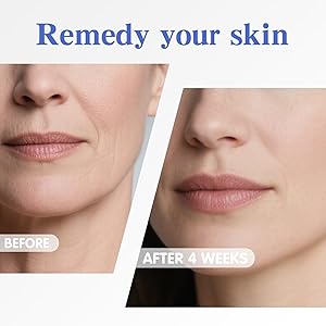 Neck Firming Cream | Face Moisturizer for Women - Anti Aging Formula for Tightening and Firming with Retinol,Collagen,Hyaluronic Acid | Day & Night Moisturizer Suited for Most Skin Types,1.7 OZ